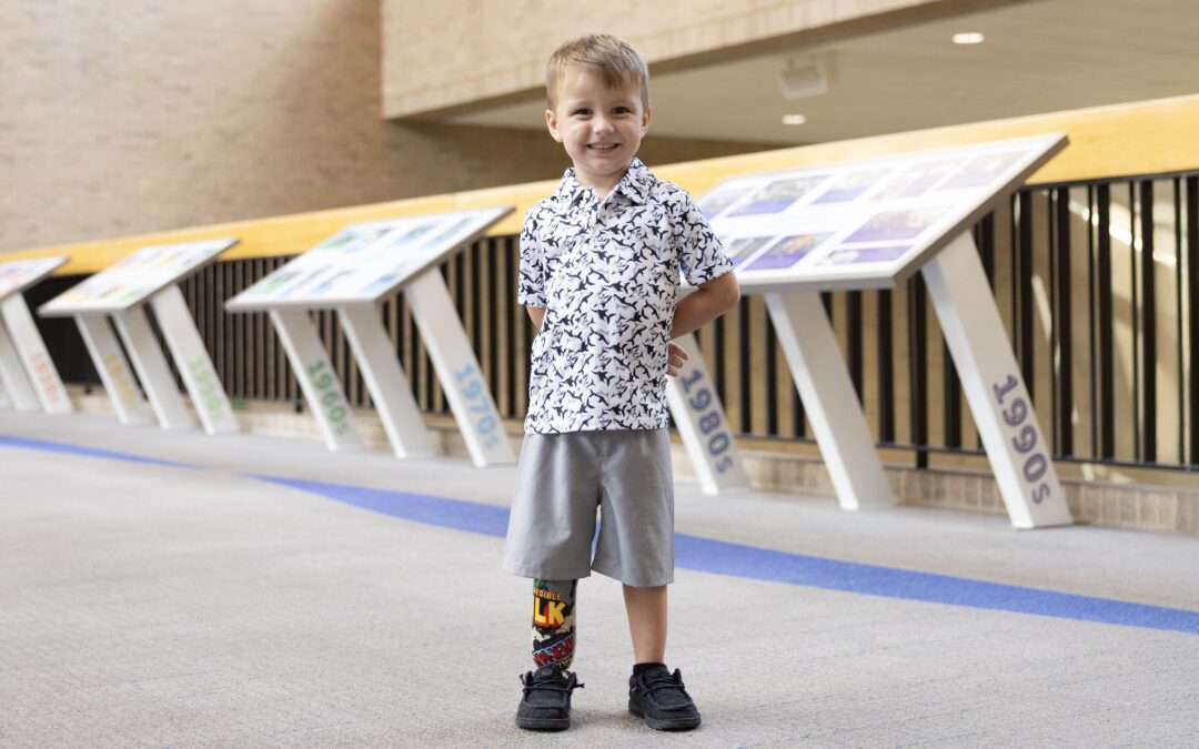 Limb Loss and Limb Differences: Terms You Need to Know